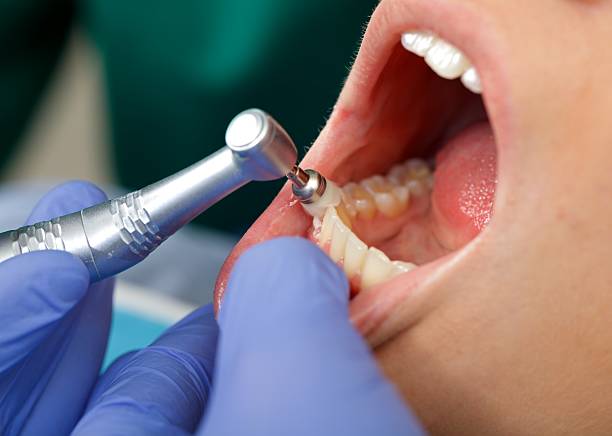 Laser Dentistry in Cosmopolis, WA